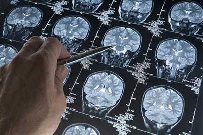 Memory-based test predicts future disease
