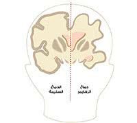 لماذا اسرعت جمعية الباقيات الصالحات فى انشاء عيادة الفحص المبكر عن الزهايمر؟